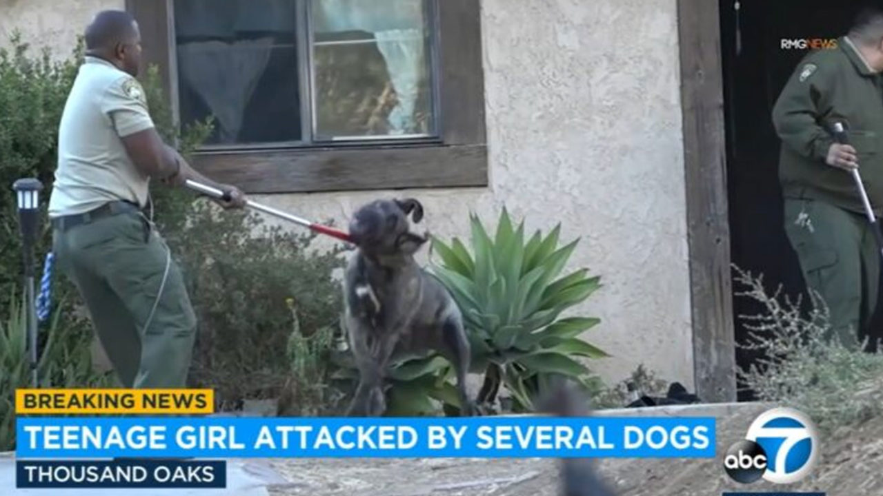 Teen girl hospitalized after Sever Dog bites in Thousand Oaks
